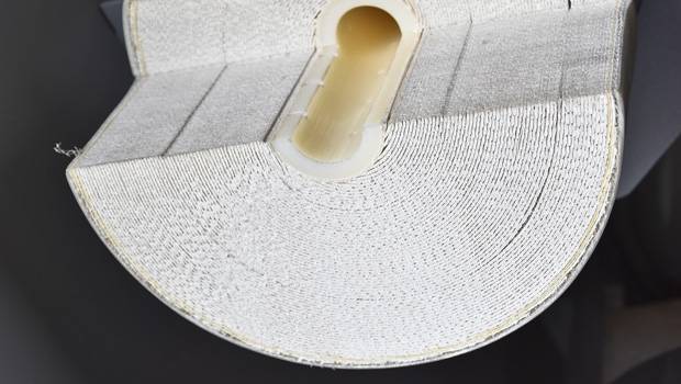 AEP : les files membranaires bientôt remplacées ?